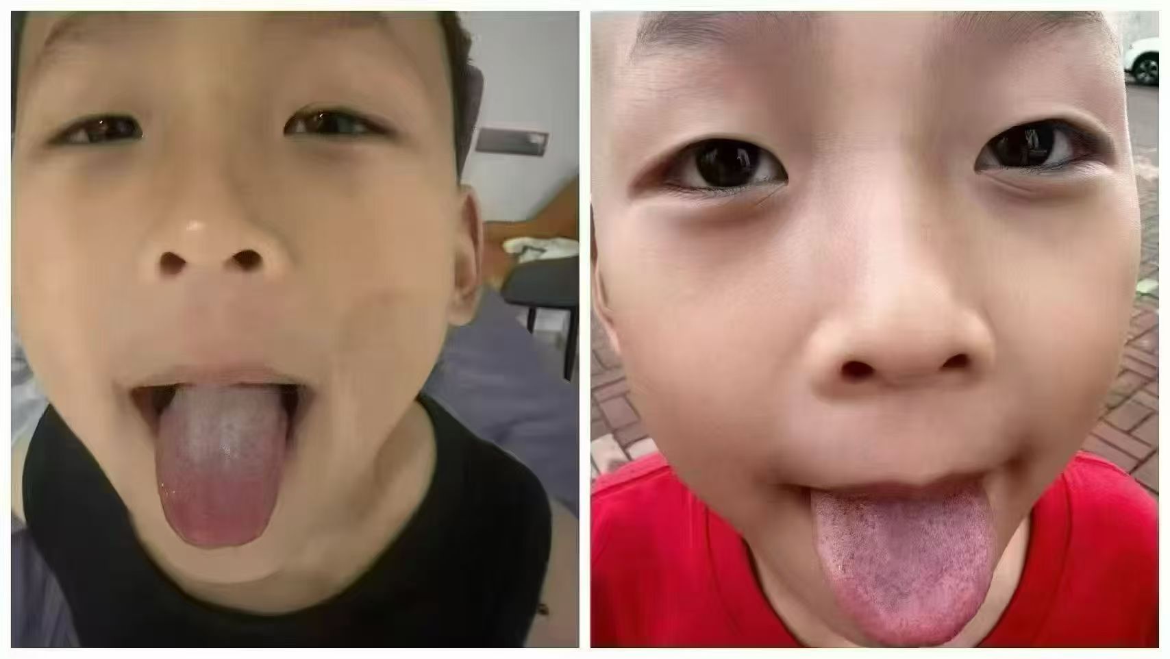 6岁半的孩子，脾胃好了，积食好了 排便好了，长高了[强] 你家喝了多少年牛奶，这些问题改善没？ 配图