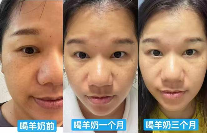 三个反馈 皮肤同时变好[憨笑] 如果是一个人反馈，可能是偶尔，也许刚好这段时间做了一些生活上的调整， 配图