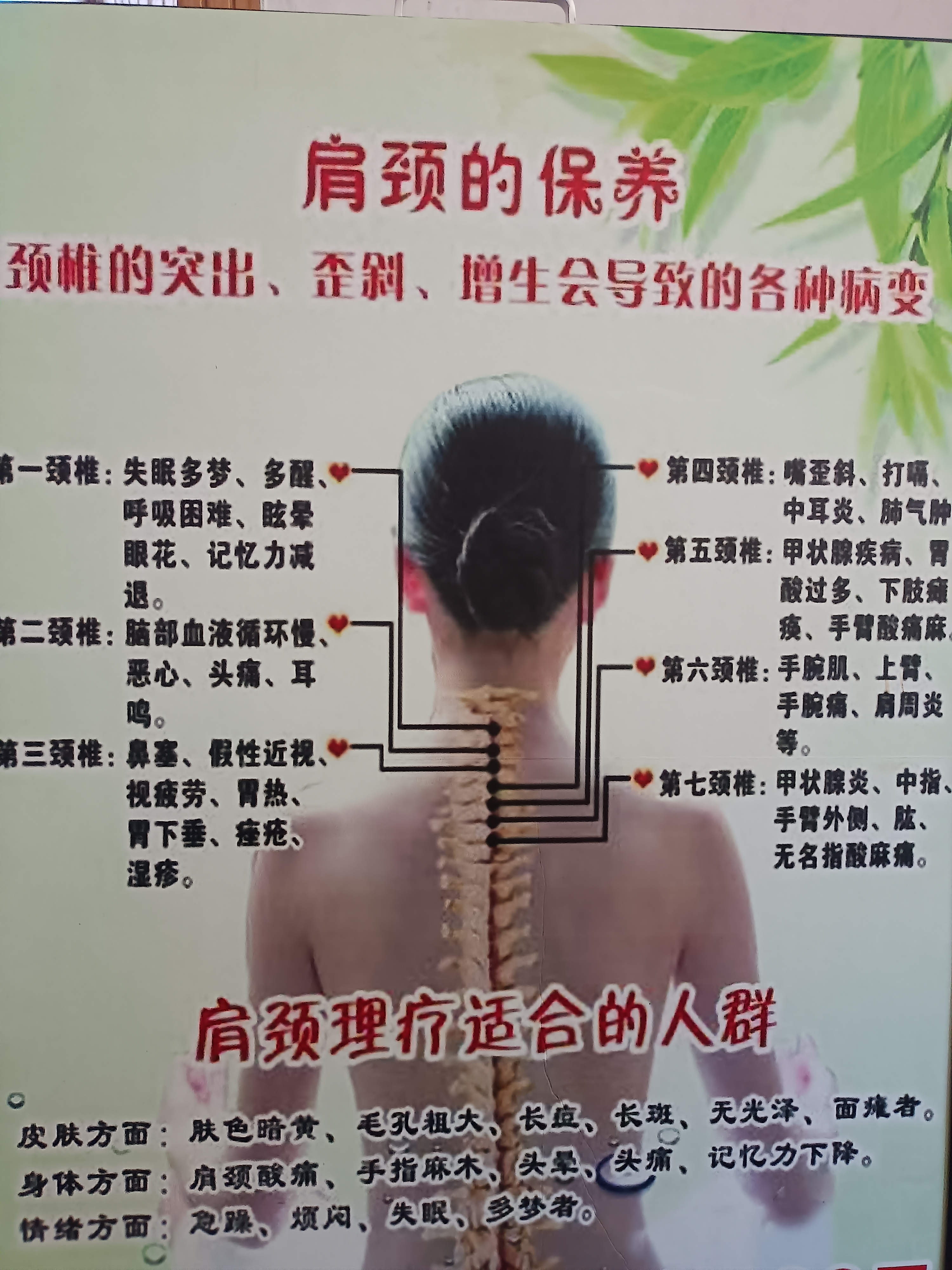 中医经络调理魏艳武视力矫正 实景图